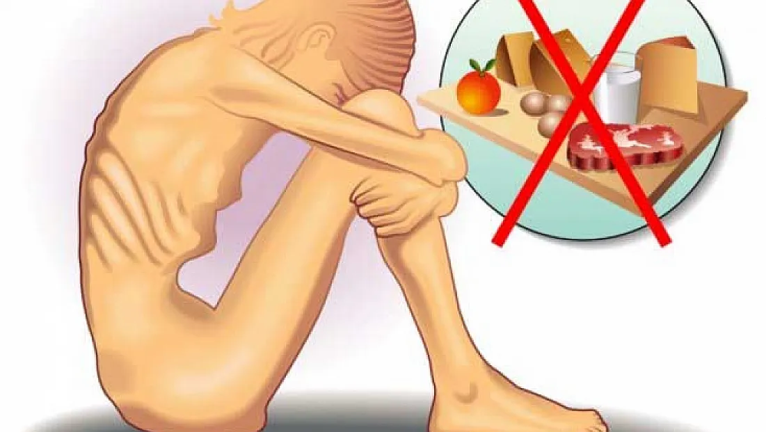 Anoreksiya nervoza hayatınızı tehdit edebilir: Yeme bozukluklarına dikkat