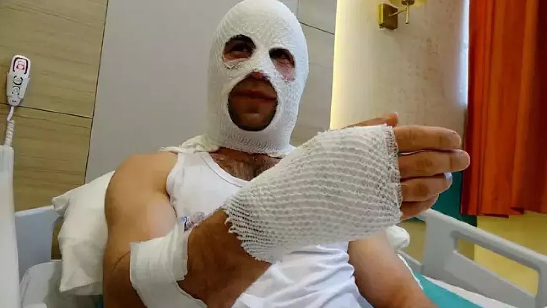 Nişanlısı İçin Hazırlık Yaparken Korkunç Kaza: 'Spreyi Isıtayım Derken Ev Havaya Uçtu!'