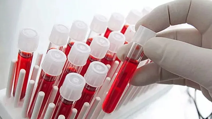 O kan grubuna sahip olanlar için bilim insanlarından uyarı geldi! Hemen hastaneye gidin yoksa kalp krizi ve felç geçirebilirsiniz