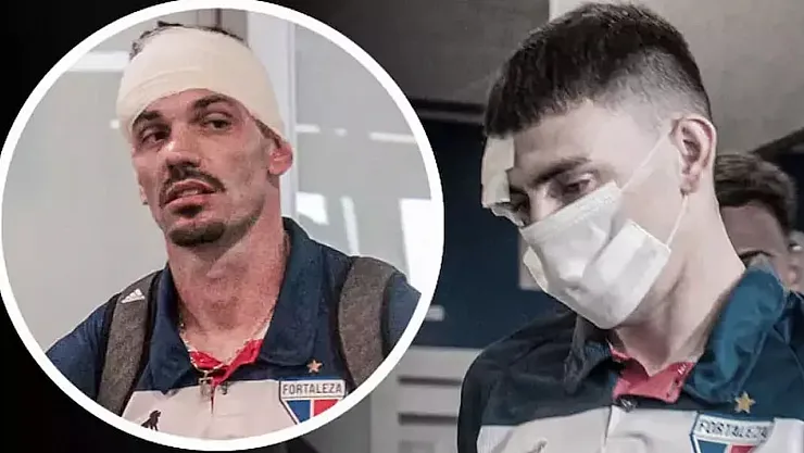 Brezilya'da Şok Edici Olay: Fortaleza Futbol Takımının Otobüsüne Bombalı Saldırı