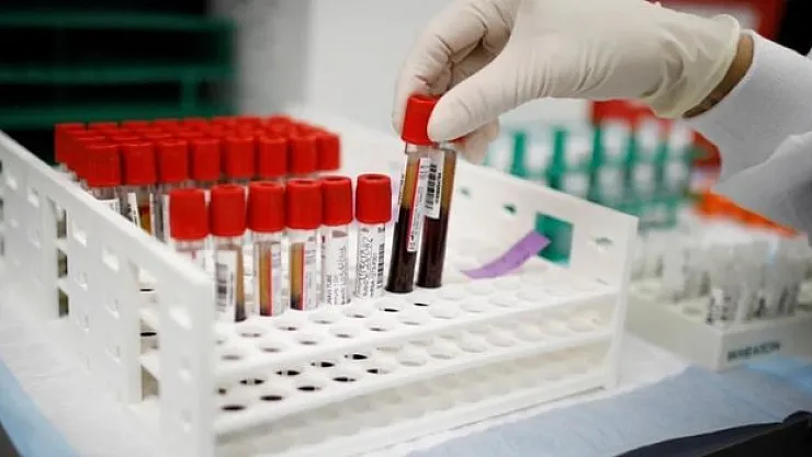 Kan grupları ve kanser riski: Şaşırtıcı sonuçlar