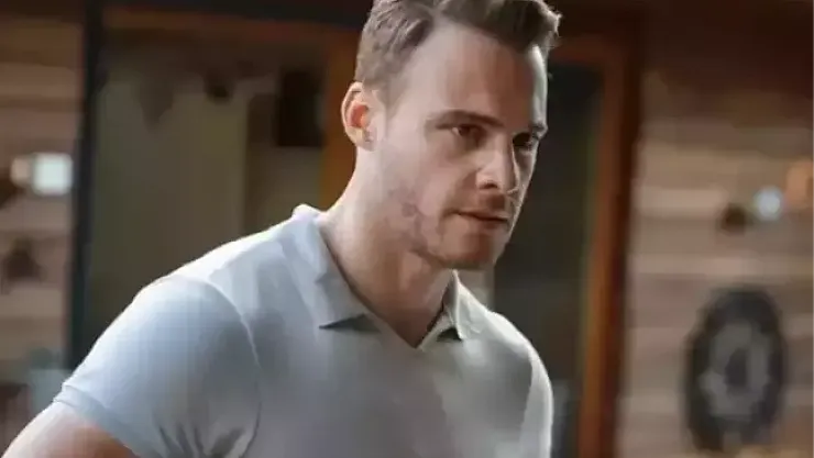 Kerem Bürsin saç mı ektirdi?