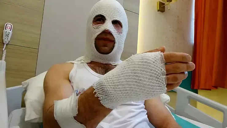 Nişanlısı İçin Hazırlık Yaparken Korkunç Kaza: 'Spreyi Isıtayım Derken Ev Havaya Uçtu!'