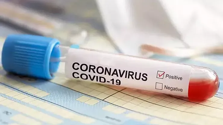 Tıp Sektöründe Bomba Etkisi Yapan Gelişme: Pandeminin Yıldızı Türklab Konkordato İlan Etti!