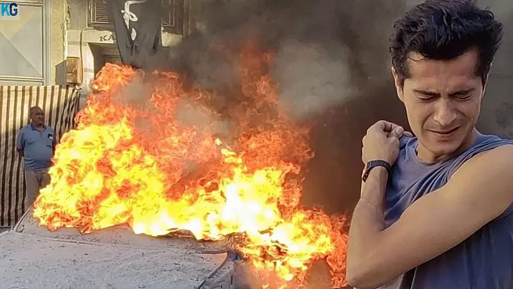 İsmail Hacıoğlu ölümden döndü! Yüzüne fünye patlayan oyuncu hastanelik oldu! İsmail Hacıoğlu sağlık durumu nasıl?